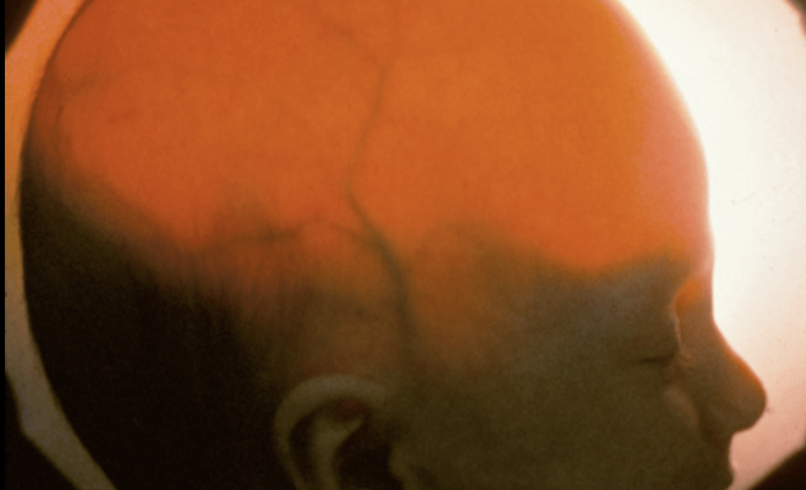 Inside the stealthy startup that pitched brainless human clones